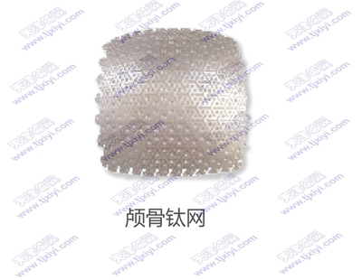颅骨钛网
